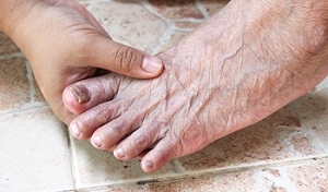 How To Prevent Toenail Fungus