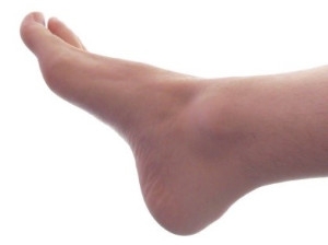 How Can I Help My Flat Feet?